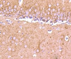 beta-III Tubulin Antibody (SP06-00), Novus Biologicals 100&mu;L:Antibodies,