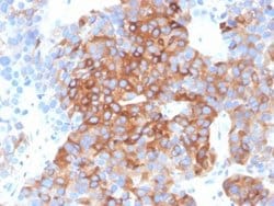beta-III Tubulin Antibody (TUBB3/3732) - Azide and BSA Free, Novus Biologicals