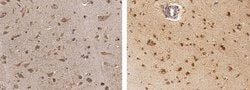 beta-NGF Rabbit anti-Human, Clone: D03, Novus Biologicals:Antibodies:Primary