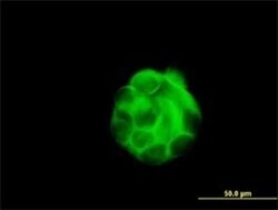 beta Sarcoglycan Antibody (1C10), Novus Biologicals 100 &mu;g | Buy Online | Novus Biologicals | Fisher Scientific