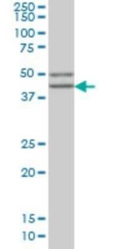 beta Sarcoglycan Antibody (1C10), Novus Biologicals 100 &mu;g | Buy Online | Novus Biologicals | Fisher Scientific
