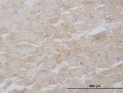 Novus Biologicals beta Sarcoglycan Antibody (1E3), Novus Biologicals 0.1 mg | Buy Online | Novus Biologicals&trade; | Fisher Scientific