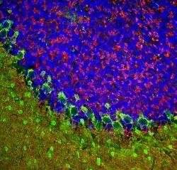 beta-Synuclein Antibody, Novus Biologicals 50 &mu;g; Unconjugated:Antibodies,