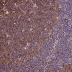 beta Tubulin Antibody, Novus Biologicals 100&mu;L; Unlabeled:Antibodies,