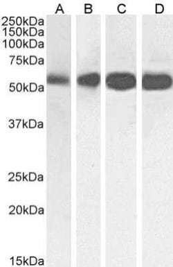 beta Tubulin, Rabbit anti-Human, Clone: S11B, Novus Biologicals 0.025 mg;