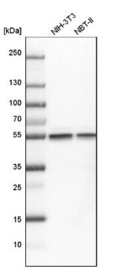 beta Tubulin Antibody, Novus Biologicals 100&mu;L; Unlabeled:Antibodies,