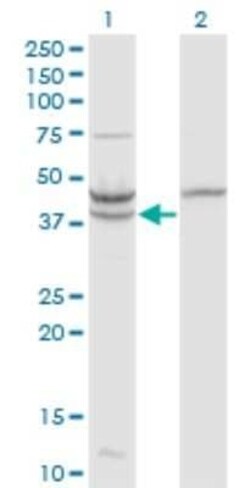beta ureidopropionase Antibody (3F12), Novus Biologicals 0.1 mg | Buy Online | Novus Biologicals | Fisher Scientific