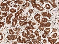 c-Abl Antibody, Novus Biologicals 100 &mu;g; Unconjugated:Antibodies, Polyclonal