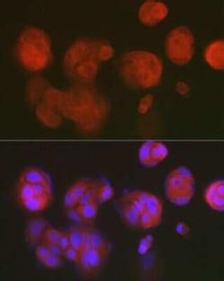c-Myc-responsive protein Rcl Rabbit anti-Human, Mouse, Clone: 7C1Z8, Novus