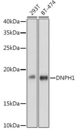 c-Myc-responsive protein Rcl Rabbit anti-Human, Mouse, Clone: 7C1Z8, Novus