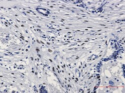 c-jun, p Ser63 Antibody (S07-3G7), Novus Biologicals:Antibodies:Primary