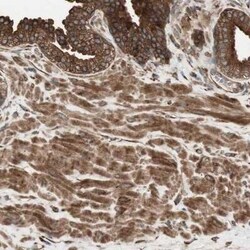 cGK1/PRKG1 Antibody, Novus Biologicals 0.1 mL | Buy Online | Novus Biologicals | Fisher Scientific