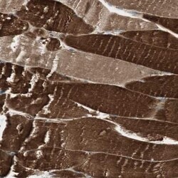 cGK1/PRKG1 Antibody, Novus Biologicals 0.1 mL | Buy Online | Novus Biologicals | Fisher Scientific