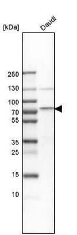 cIAP-2/HIAP-1 Antibody, Novus Biologicals 25 &mu;L | Buy Online | Novus Biologicals | Fisher Scientific