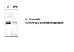 cIAP-2/HIAP-1 Antibody, Novus Biologicals 25 &mu;L | Buy Online | Novus Biologicals | Fisher Scientific