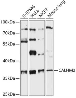 calcium homeostasis modulator 2 Antibody - Azide and BSA Free, Novus Biologicals:Antibodies:Primary