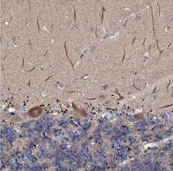 ch-TOG Antibody, Novus Biologicals 0.1 mL | Buy Online | Novus Biologicals | Fisher Scientific