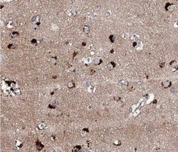 ch-TOG Antibody, Novus Biologicals 0.1 mL | Buy Online | Novus Biologicals | Fisher Scientific