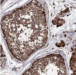 ch-TOG Antibody, Novus Biologicals 0.1 mL | Buy Online | Novus Biologicals | Fisher Scientific