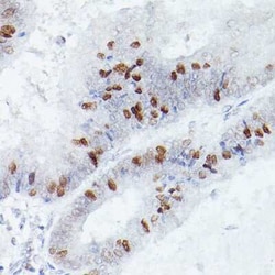 csl/RBPJK Rabbit anti-Human, Mouse, Clone: 9B3L6, Novus Biologicals 100