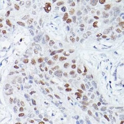 csl/RBPJK Rabbit anti-Human, Mouse, Clone: 9B3L6, Novus Biologicals 100