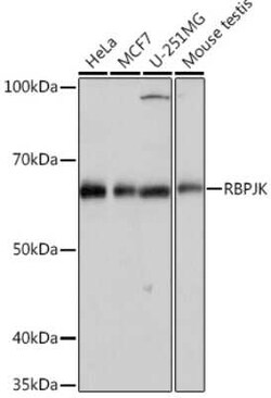csl/RBPJK Rabbit anti-Human, Mouse, Clone: 9B3L6, Novus Biologicals 100