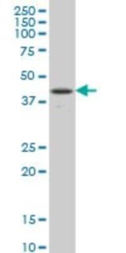 Novus Biologicals csl/RBPJK Antibody (4E12), Novus Biologicals 0.05 mg | Buy Online | Novus Biologicals&trade; | Fisher Scientific