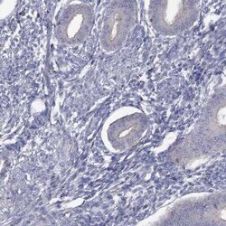 dedicator of cytokinesis 8 Rabbit anti-Human, Polyclonal, Novus Biologicals:Antibodies:Primary
