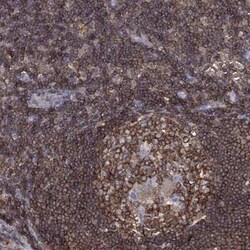 dedicator of cytokinesis 8 Rabbit anti-Human, Polyclonal, Novus Biologicals:Antibodies:Primary