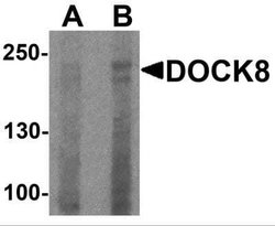 dedicator of cytokinesis 8 Antibody - BSA Free, Novus Biologicals 0.1 mg | Buy Online | Novus Biologicals | Fisher Scientific