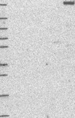 dedicator of cytokinesis 8 Rabbit anti-Human, Polyclonal, Novus Biologicals:Antibodies:Primary