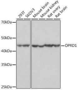 delta Opioid R/OPRD1 Rabbit anti-Human, Mouse, Rat, Clone: 1R4W8, Novus Biologicals 20 &mu;g | Buy Online | Bio-Techne | Fisher Scientific