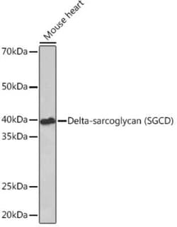 delta-Sarcoglycan Rabbit anti-Human, Mouse, Clone: 3P3R4, Novus Biologicals