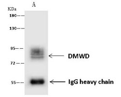 dystrophia myotonica containing WD repeat motif Antibody, Novus Biologicals:Antibodies:Primary