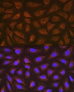 eEF-2 Rabbit anti-Human, Mouse, Rat, Clone: 4E2Z5, Novus Biologicals:Antibodies:Primary