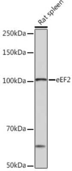 eEF-2 Rabbit anti-Human, Mouse, Rat, Clone: 4E2Z5, Novus Biologicals:Antibodies:Primary