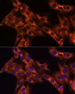 eEF1A1 Rabbit anti-Human, Mouse, Rat, Clone: 0X0H8, Novus Biologicals 20 &mu;g | Buy Online | Novus Biologicals | Fisher Scientific