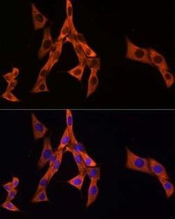 eEF1A1 Rabbit anti-Human, Mouse, Rat, Clone: 0X0H8, Novus Biologicals 20 &mu;g | Buy Online | Novus Biologicals | Fisher Scientific