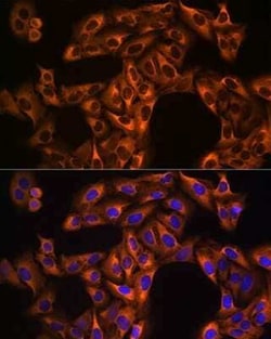 eEF1A1 Rabbit anti-Human, Mouse, Rat, Clone: 0X0H8, Novus Biologicals 20 &mu;g | Buy Online | Novus Biologicals | Fisher Scientific