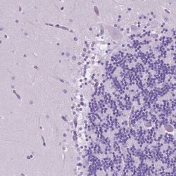 eEF1A2 binding protein Antibody, Novus Biologicals:Antibodies:Primary Antibodies