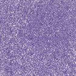 eEF1A2 binding protein Antibody, Novus Biologicals:Antibodies:Primary Antibodies