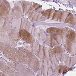 eEF1A2 binding protein Antibody, Novus Biologicals:Antibodies:Primary Antibodies