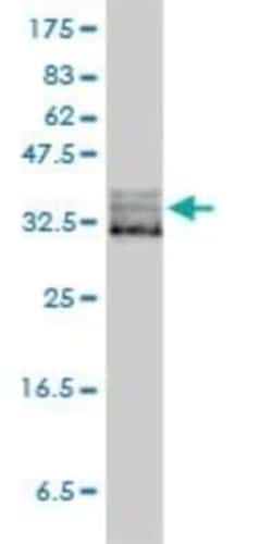 eIF2 alpha/EIF2S1 Antibody (3H12-C11), Novus Biologicals 0.1 mg | Buy Online | Novus Biologicals | Fisher Scientific