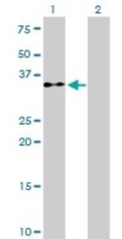eIF2 alpha/EIF2S1 Antibody (3H12-C11), Novus Biologicals 0.1 mg | Buy Online | Novus Biologicals | Fisher Scientific