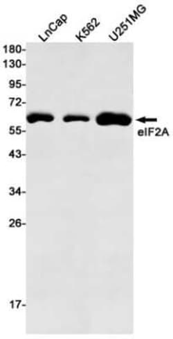 eIF2A Rabbit anti-Human, Mouse, Rat, Clone: S08-8E2, Novus Biologicals