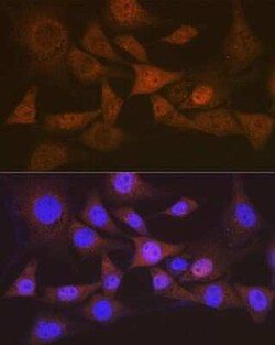 eIF2B epsilon Rabbit anti-Human, Mouse, Rat, Clone: 5M2D4, Novus Biologicals:Antibodies:Primary
