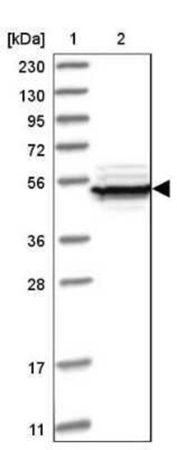 eIF2B3 Antibody, Novus Biologicals 25 &mu;L; Unconjugated:Antibodies, Polyclonal
