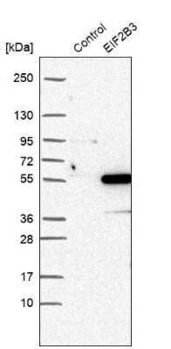 eIF2B3 Antibody, Novus Biologicals 0.1 mL | Buy Online | Novus Biologicals | Fisher Scientific