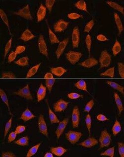 eIF2B4 Antibody - Azide and BSA Free, Novus Biologicals:Antibodies:Primary