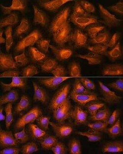 eIF2B4 Antibody - Azide and BSA Free, Novus Biologicals:Antibodies:Primary